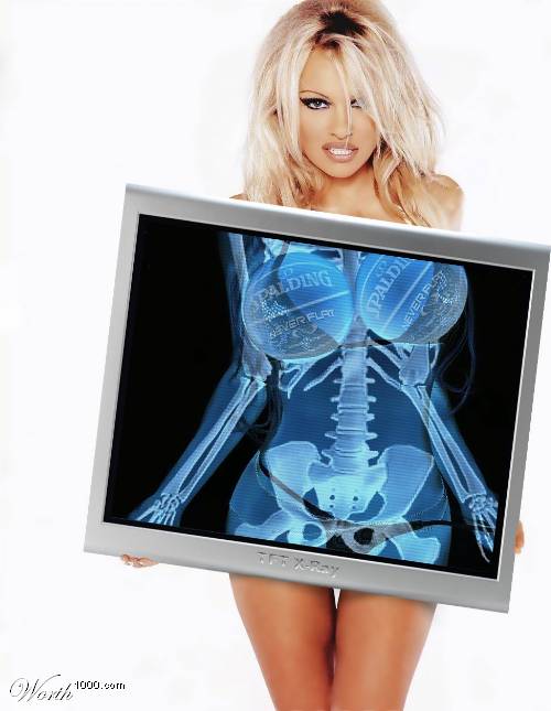 Pamela Anderson rayos-x